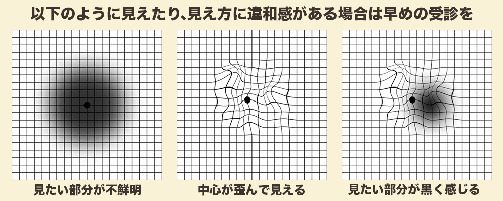 アムスラーチャート