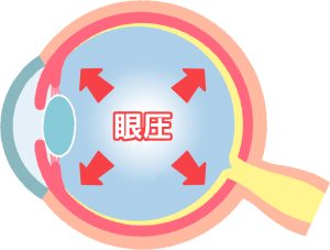 眼圧