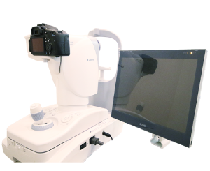 無散瞳デジタル眼底カメラ