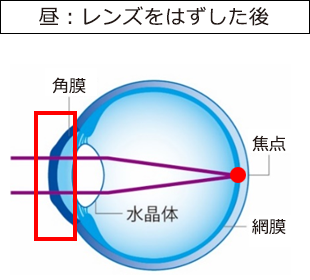 オルソケラトロジーによる近視矯正の仕組み3